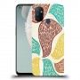 כיסוי מעוצב - ציפורים או לא לדגם : OnePlus Nord N100 מותג : סקרין מובייל