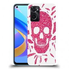 כיסוי מעוצב - בורדו סקול לדגם : Oppo A76 מותג : סקרין מובייל