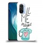 כיסוי מעוצב - תתקשר אלי אולי לדגם : Xiaomi Mi 11i מותג : סקרין מובייל