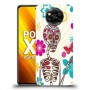 כיסוי מעוצב - סקדה בהירה לדגם : Xiaomi Poco X3 מותג : סקרין מובייל