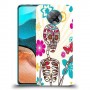 כיסוי מעוצב - סקדה בהירה לדגם : Xiaomi Redmi K30 Pro מותג : סקרין מובייל