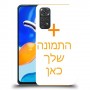 כיסוי מגן קשיח בעיצוב אישי עם התמונות שלךתמונה אחת לדגם : Xiaomi Redmi Note 11S מותג : סקרין מובייל