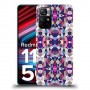 כיסוי מעוצב - קליידוסקופ לדגם : Xiaomi Redmi Note 11T 5G מותג : סקרין מובייל
