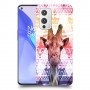 ג'ירפה נחמד כיסוי מגן קשיח מעוצב ל OnePlus 9 יחידה אחת סקרין מובייל
