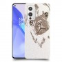 דיוקן סולד כיסוי מגן קשיח מעוצב ל OnePlus 9 יחידה אחת סקרין מובייל