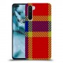 סקוטש כיסוי מגן קשיח מעוצב ל OnePlus Nord יחידה אחת סקרין מובייל