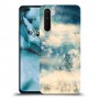 יופי חורף כיסוי מגן קשיח מעוצב ל OnePlus Nord יחידה אחת סקרין מובייל