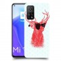 אדג אדום במשקפיים כיסוי מגן קשיח מעוצב ל Xiaomi Mi 10T 5G יחידה אחת סקרין מובייל
