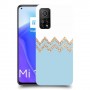 לבן כחול כיסוי מגן קשיח מעוצב ל Xiaomi Mi 10T 5G יחידה אחת סקרין מובייל