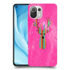 מוזה כיסוי מגן קשיח מעוצב ל Xiaomi Mi 11 Lite 5G יחידה אחת סקרין מובייל