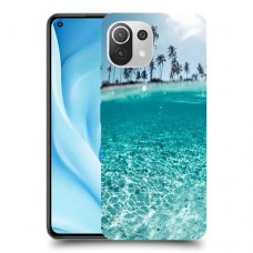 חופשה גן עדן כיסוי מגן קשיח מעוצב ל Xiaomi Mi 11 Lite 5G יחידה אחת סקרין מובייל