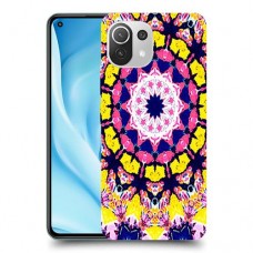 מנדלה כיסוי מגן קשיח מעוצב ל Xiaomi Mi 11 Lite 5G יחידה אחת סקרין מובייל