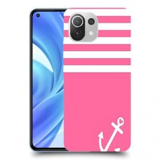 ורוד ימית כיסוי מגן קשיח מעוצב ל Xiaomi Mi 11 Lite יחידה אחת סקרין מובייל