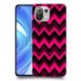 קווי סגול כיסוי מגן קשיח מעוצב ל Xiaomi Mi 11 Lite יחידה אחת סקרין מובייל