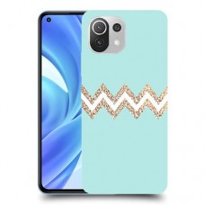 פסים בירוק כיסוי מגן קשיח מעוצב ל Xiaomi Mi 11 Lite יחידה אחת סקרין מובייל