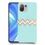 פסים בירוק כיסוי מגן קשיח מעוצב ל Xiaomi Mi 11 Lite יחידה אחת סקרין מובייל