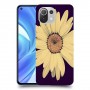 חמניות בשחור כיסוי מגן קשיח מעוצב ל Xiaomi Mi 11 Lite יחידה אחת סקרין מובייל
