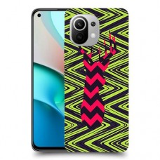עניבה על גרין כיסוי מגן קשיח מעוצב ל Xiaomi Mi 11 יחידה אחת סקרין מובייל
