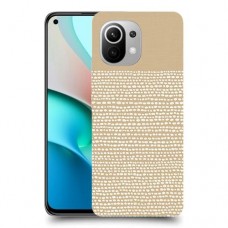 נקודות לבנות כיסוי מגן קשיח מעוצב ל Xiaomi Mi 11 יחידה אחת סקרין מובייל