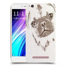 דיוקן סולד כיסוי מגן קשיח מעוצב ל Xiaomi Redmi 4A יחידה אחת סקרין מובייל