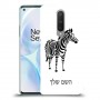 זברה כיסוי מגן קשיח בעיצוב אישי עם השם שלך ל OnePlus 8 יחידה אחת סקרין מובייל