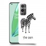 זברה כיסוי מגן קשיח בעיצוב אישי עם השם שלך ל OnePlus 9 Pro יחידה אחת סקרין מובייל