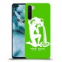 דלי כיסוי מגן קשיח בעיצוב אישי עם השם שלך ל OnePlus Nord יחידה אחת סקרין מובייל