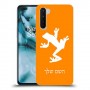צפרדע טרופית כיסוי מגן קשיח בעיצוב אישי עם השם שלך ל OnePlus Nord יחידה אחת סקרין מובייל