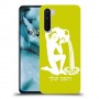 דלי כיסוי מגן קשיח בעיצוב אישי עם השם שלך ל OnePlus Nord יחידה אחת סקרין מובייל