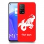 גדי כיסוי מגן קשיח בעיצוב אישי עם השם שלך ל Xiaomi Mi 10T 5G יחידה אחת סקרין מובייל