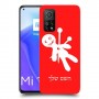 וודו כיסוי מגן קשיח בעיצוב אישי עם השם שלך ל Xiaomi Mi 10T 5G יחידה אחת סקרין מובייל