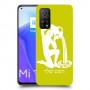 דלי כיסוי מגן קשיח בעיצוב אישי עם השם שלך ל Xiaomi Mi 10T 5G יחידה אחת סקרין מובייל