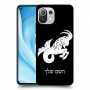 גדי כיסוי מגן קשיח בעיצוב אישי עם השם שלך ל Xiaomi Mi 11 Lite 5G יחידה אחת סקרין מובייל