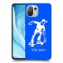 ילד סקייטבורד כיסוי מגן קשיח בעיצוב אישי עם השם שלך ל Xiaomi Mi 11 Lite 5G יחידה אחת סקרין מובייל