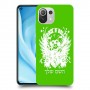רוקנרול כיסוי מגן קשיח בעיצוב אישי עם השם שלך ל Xiaomi Mi 11 Lite 5G יחידה אחת סקרין מובייל