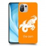 גדי כיסוי מגן קשיח בעיצוב אישי עם השם שלך ל Xiaomi Mi 11 Lite 5G יחידה אחת סקרין מובייל