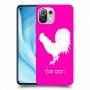 תרנגול כיסוי מגן קשיח בעיצוב אישי עם השם שלך ל Xiaomi Mi 11 Lite 5G יחידה אחת סקרין מובייל