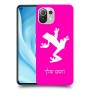 צפרדע טרופית כיסוי מגן קשיח בעיצוב אישי עם השם שלך ל Xiaomi Mi 11 Lite 5G יחידה אחת סקרין מובייל