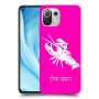 סרטן כיסוי מגן קשיח בעיצוב אישי עם השם שלך ל Xiaomi Mi 11 Lite 5G יחידה אחת סקרין מובייל