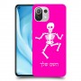 שלד כיסוי מגן קשיח בעיצוב אישי עם השם שלך ל Xiaomi Mi 11 Lite 5G יחידה אחת סקרין מובייל