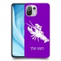 סרטן כיסוי מגן קשיח בעיצוב אישי עם השם שלך ל Xiaomi Mi 11 Lite 5G יחידה אחת סקרין מובייל