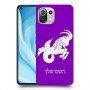 גדי כיסוי מגן קשיח בעיצוב אישי עם השם שלך ל Xiaomi Mi 11 Lite 5G יחידה אחת סקרין מובייל