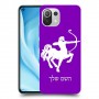 קשת כיסוי מגן קשיח בעיצוב אישי עם השם שלך ל Xiaomi Mi 11 Lite 5G יחידה אחת סקרין מובייל