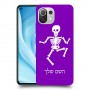 שלד כיסוי מגן קשיח בעיצוב אישי עם השם שלך ל Xiaomi Mi 11 Lite 5G יחידה אחת סקרין מובייל