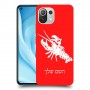 סרטן כיסוי מגן קשיח בעיצוב אישי עם השם שלך ל Xiaomi Mi 11 Lite 5G יחידה אחת סקרין מובייל