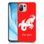גדי כיסוי מגן קשיח בעיצוב אישי עם השם שלך ל Xiaomi Mi 11 Lite 5G יחידה אחת סקרין מובייל