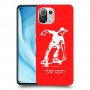 ילד סקייטבורד כיסוי מגן קשיח בעיצוב אישי עם השם שלך ל Xiaomi Mi 11 Lite 5G יחידה אחת סקרין מובייל