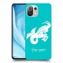 גדי כיסוי מגן קשיח בעיצוב אישי עם השם שלך ל Xiaomi Mi 11 Lite 5G יחידה אחת סקרין מובייל