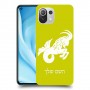 גדי כיסוי מגן קשיח בעיצוב אישי עם השם שלך ל Xiaomi Mi 11 Lite 5G יחידה אחת סקרין מובייל