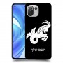 גדי כיסוי מגן קשיח בעיצוב אישי עם השם שלך ל Xiaomi Mi 11 Lite יחידה אחת סקרין מובייל